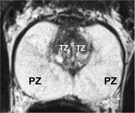 Fig 2.