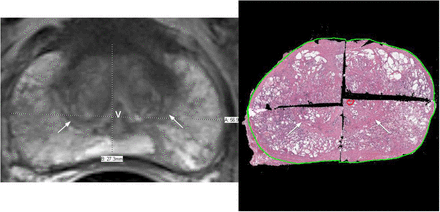 Fig 4.