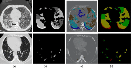 Figure 11.