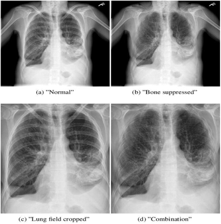 FIGURE 4.