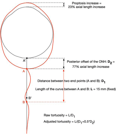 Figure.
