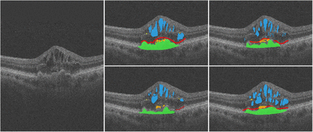 Figure 1: