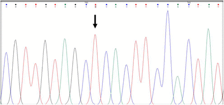 Figure 2a: