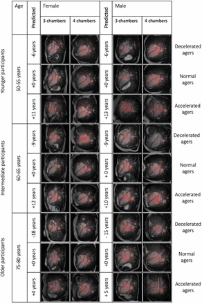 Figure 3:
