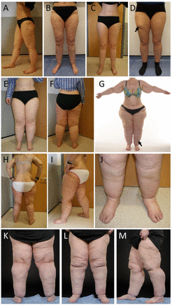 Fig 1.