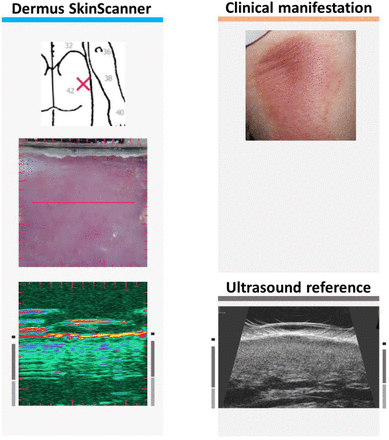 Figure 19.