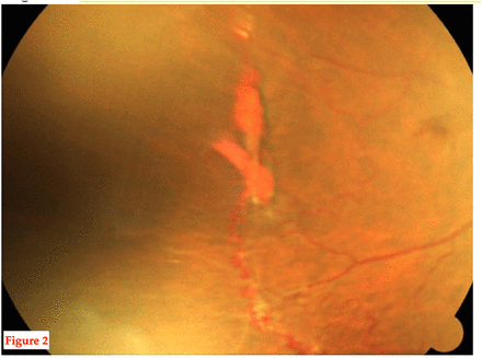 Figure 2: