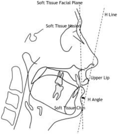 Figure 17.