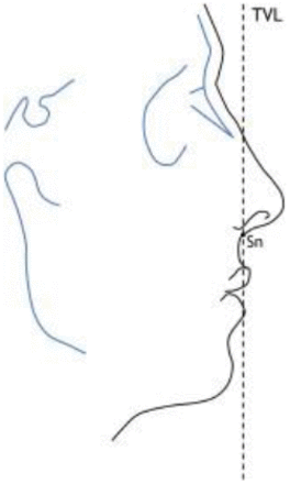 Figure 19.