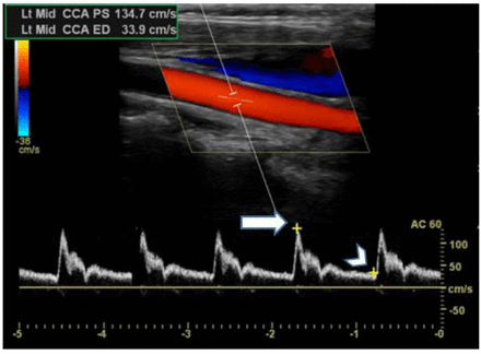 FIGURE 2.