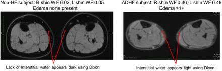 Figure 1A: