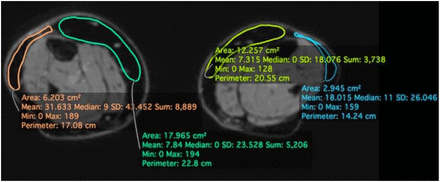 Figure 1B: