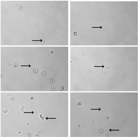 Fig.2B.
