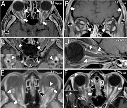 Figure 4: