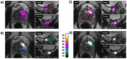 Figure 1: