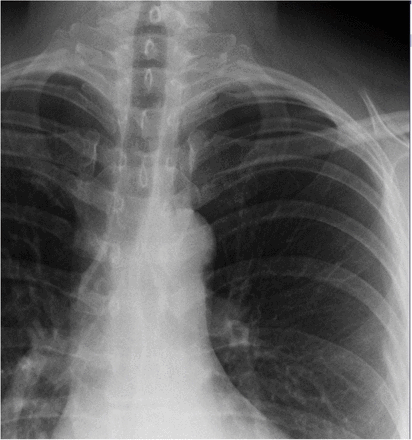 Appendix Figure 1: