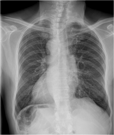 Appendix Figure 2: