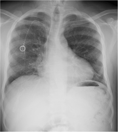 Appendix Figure 3: