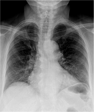 Appendix Figure 5:
