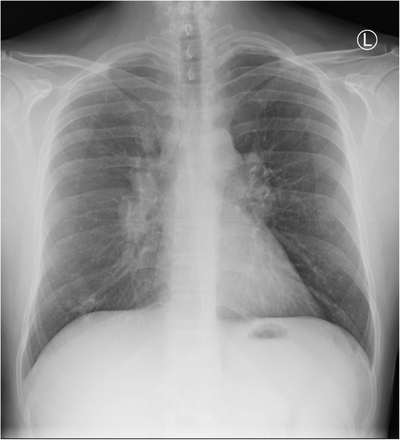 Appendix Figure 6:
