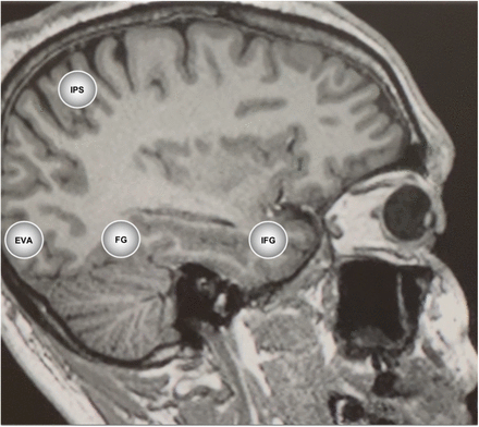 Fig 3.