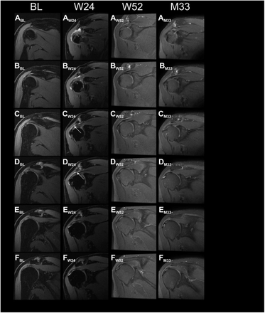 FIGURE S11.