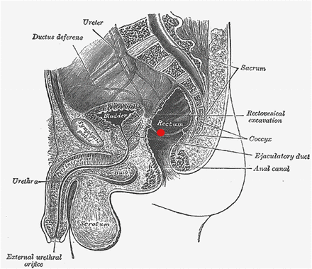 Fig. 3: