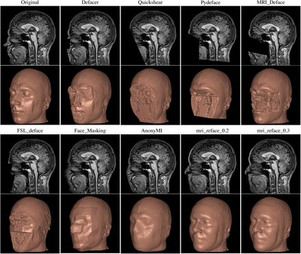 Fig 1:
