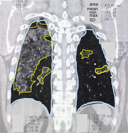 Fig 2.