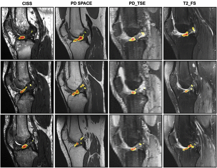 Fig 8.