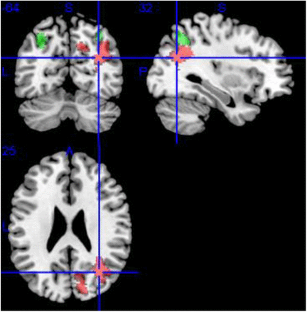 Figure 4.
