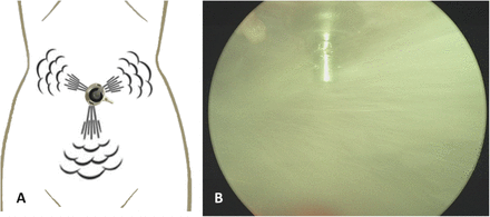 Figure 4: