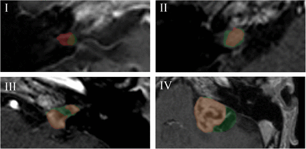 Figure 3: