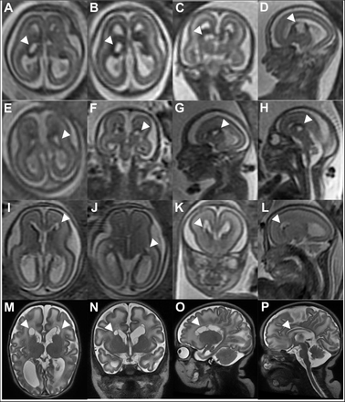 Figure 4: