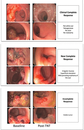 Figure 2: