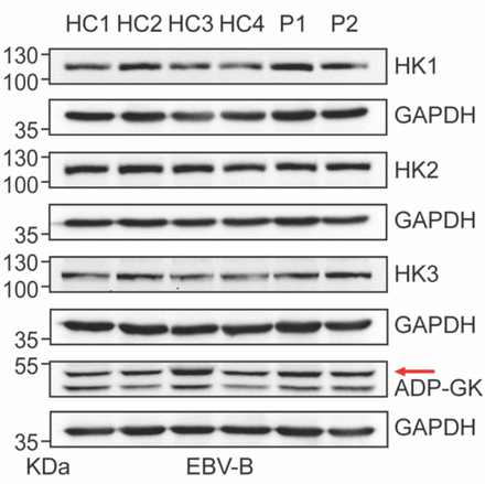 Supplementary Figure 1: