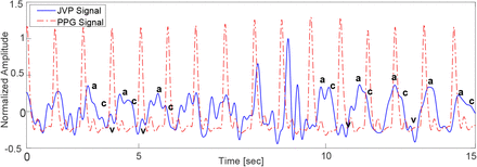 Fig. 16: