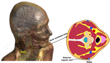 Fig. 4: